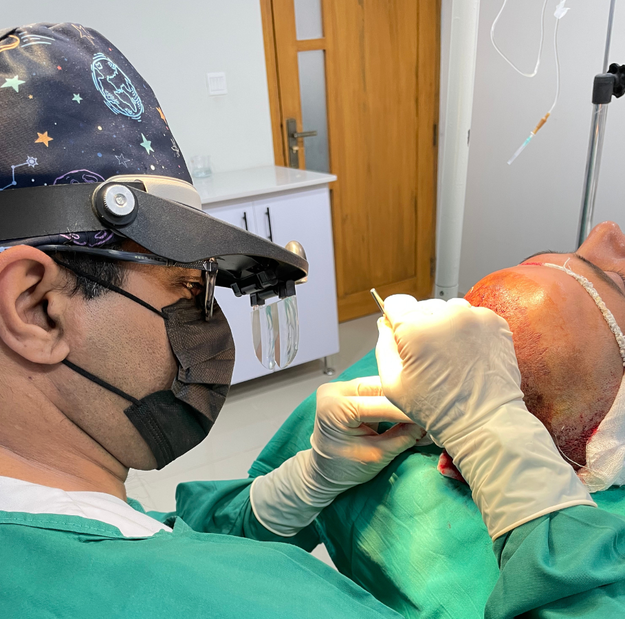 Hair transplant treatment in Karachi
