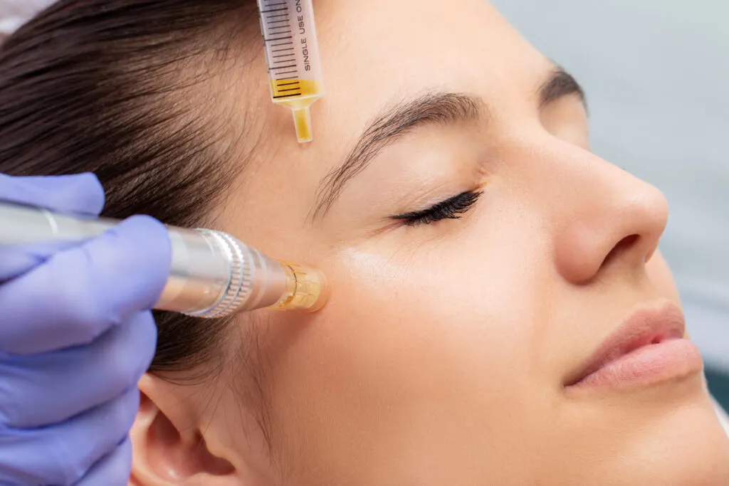 Skin Treatments Overview - Karachi
