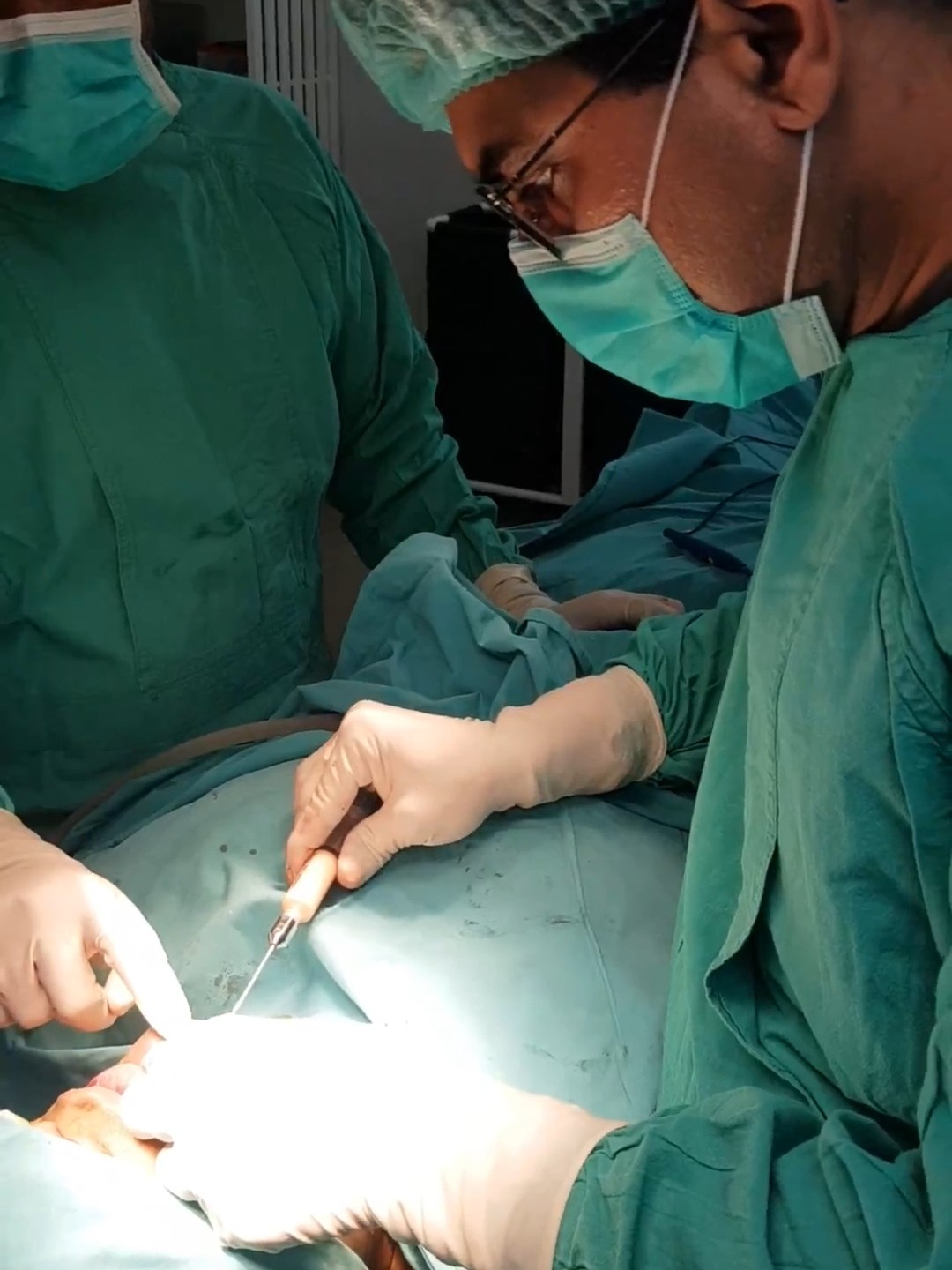 Aesthetic Surgery Results - Karachi